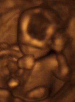3D dítě v děloze,foto: jenny cu, CC BY 2.0,cs.wikipedia.org 